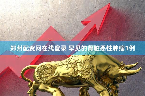 郑州配资网在线登录 罕见的肾脏恶性肿瘤1例